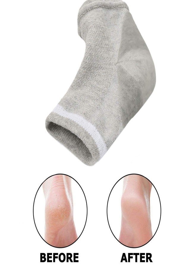 Runee Moisturizing Gel Heel Socks Open Toe For Dry, Hard, Rough, And Cracked Skin - Treatment Care For Softer Heel, 3 Pair - Image 2